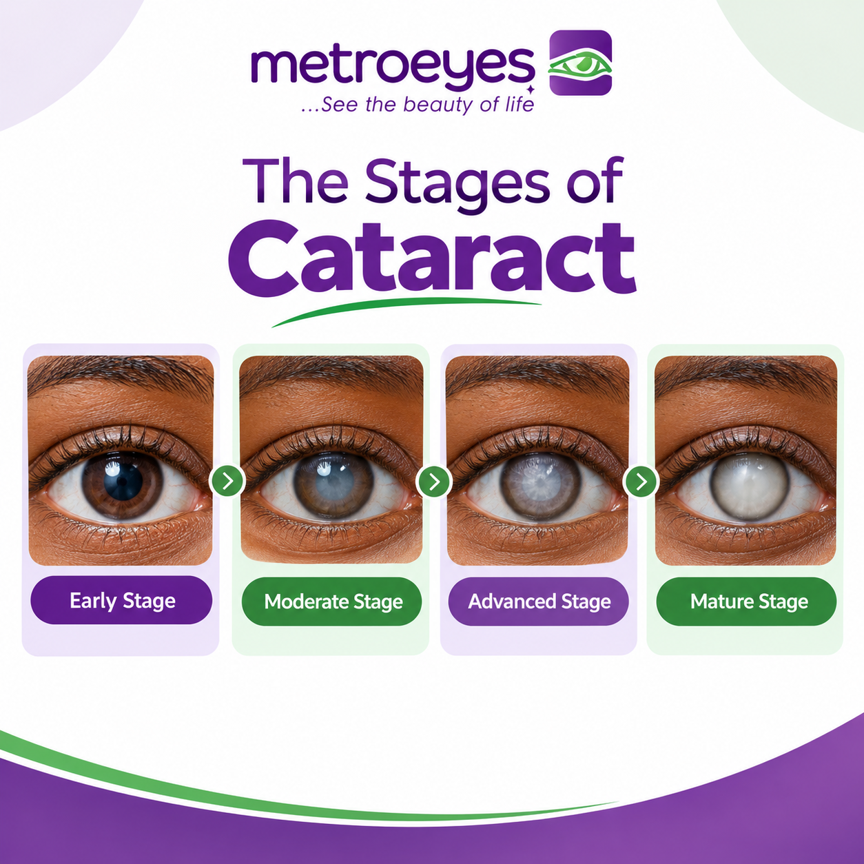 EARLY SIGNS AND SYMPTOMS OF CATARACT: WHAT YOU SHOULD KNOW